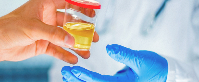 Drug Test for Weed: How to Pass a Urine Test?